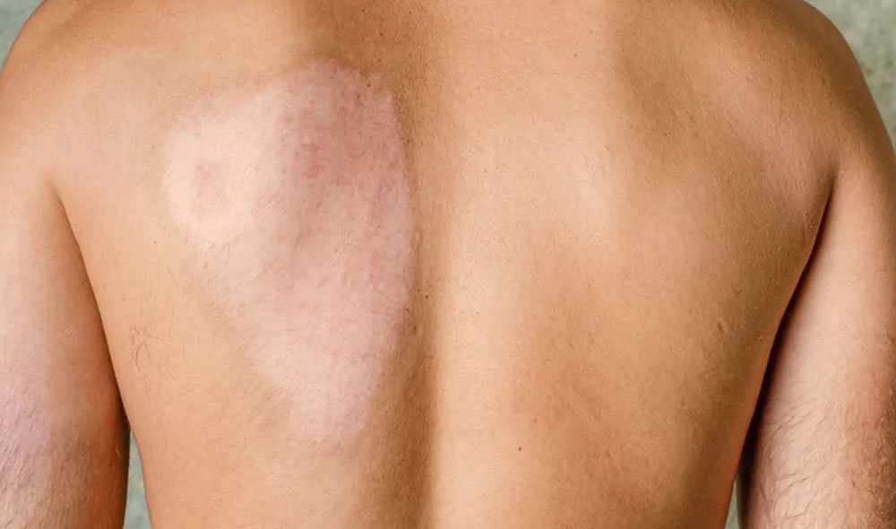 skin